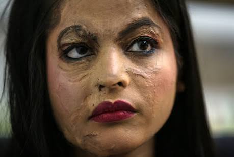 Legal aid and rights guidance for acid attack survivors